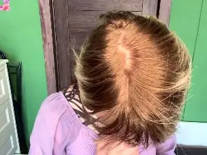 Cam4 Adult Webcams of AftonFountain